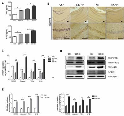 Blocking the LncRNA MALAT1/miR-224-5p/NLRP3 Axis Inhibits the Hippocampal Inflammatory Response in T2DM With OSA